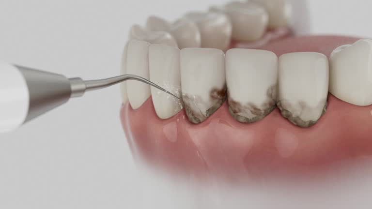 Trusted Dental Implants service in Moss Beach, CA - Dentist Open Now